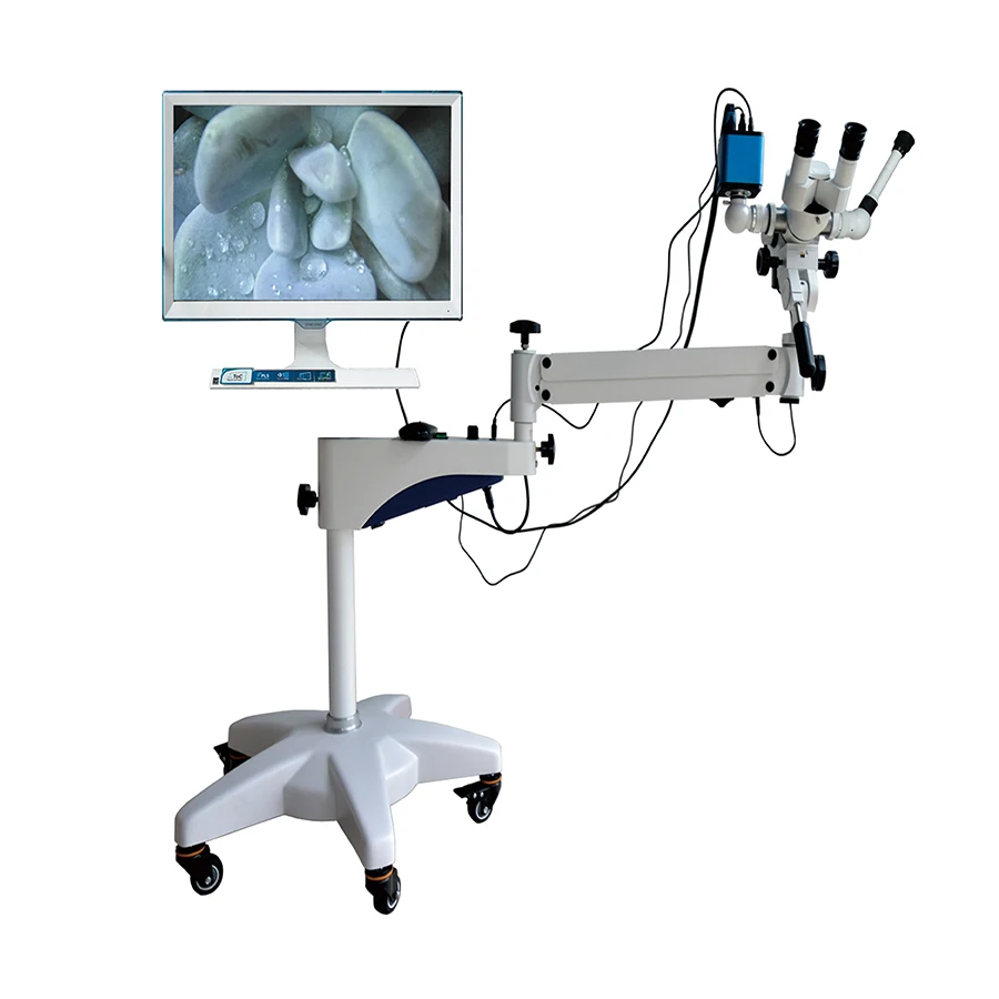 Medical Colposcope Electronic Colposcope for Gynecology Video Camera Colposcope