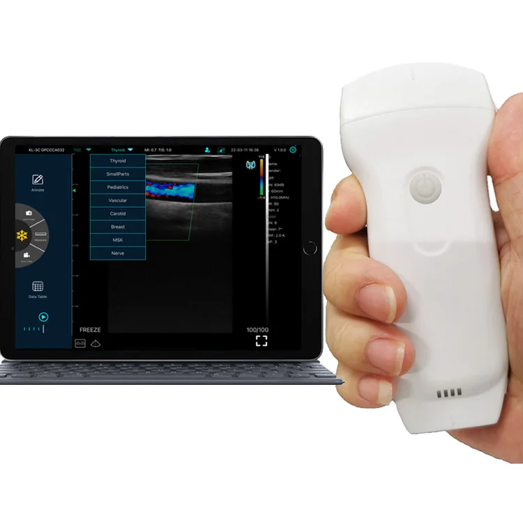 Konted C10rl 3 в 1 ультразвуковой сканер Двойной линейный выпуклый портативный ультразвук с цветным допплером