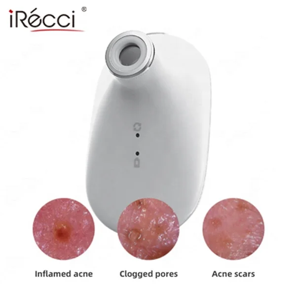 iRecci facial skin pigment scanner analysis device digital face skin dsiagnosis portable handheld skin scanner analyzer for beau