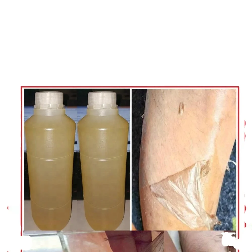 
Most Effective Yellow Peeling Oil 1 Liter Lowest Price 