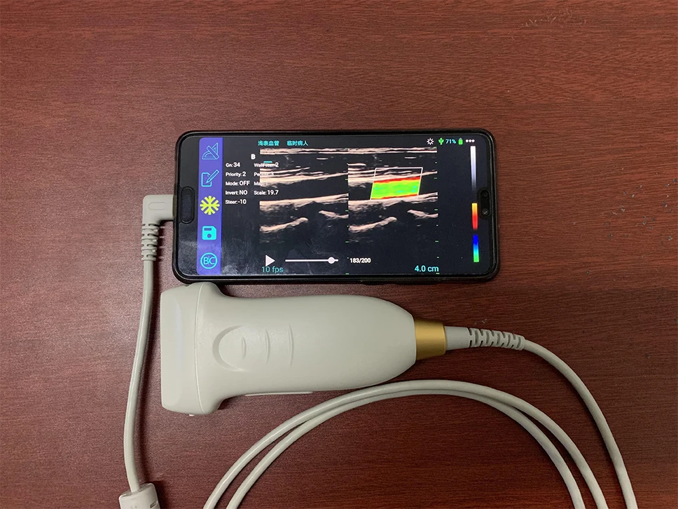 Высокотехнологичный Цветной Допплер CE USB линейный зонд ультразвуковой 14