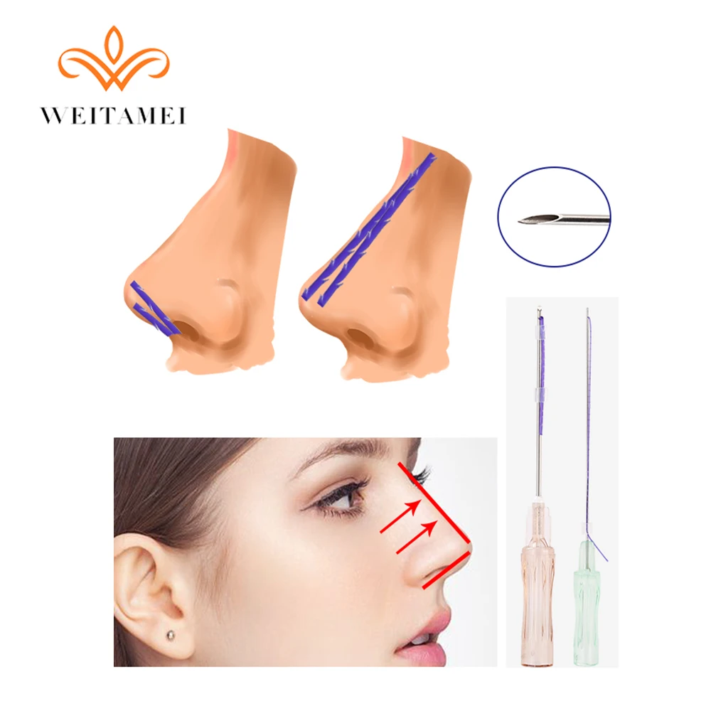 High Quality 19g 50mm Pdo Thread Lifting Nose with L Blunt Needle