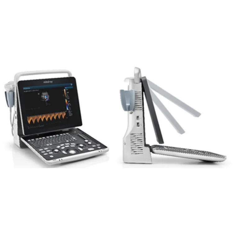 Hot sales Mindray Z50BW color doppler ultrasound diagnosis ultrasound for hospital clinic