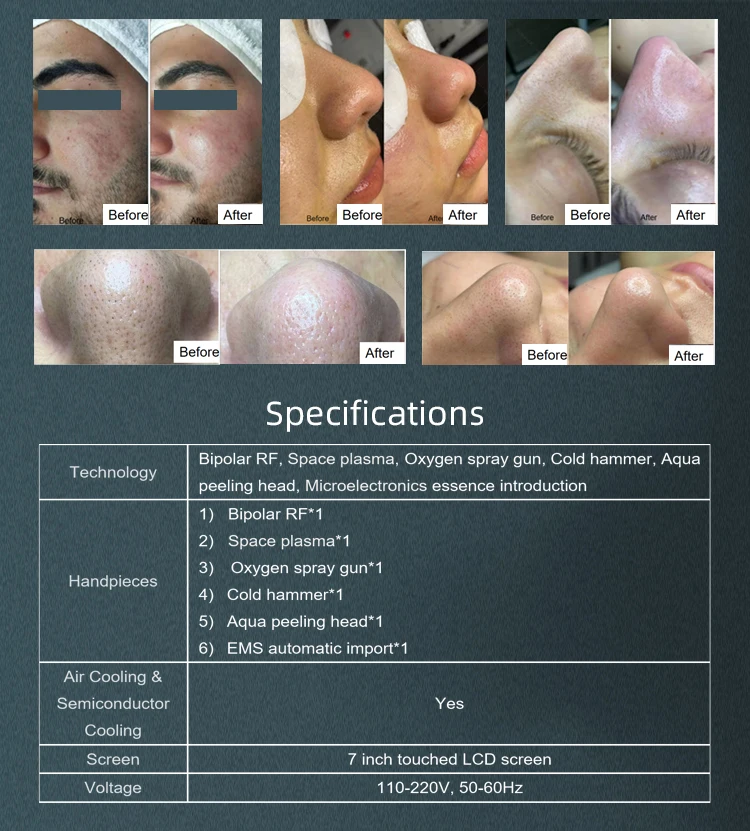 New arrival Hydrogen Oxygen hot bubble plasma for complete facial treatment