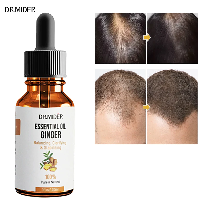 High quality essential oil manufacturer 100% organic pure private label 30ml ginger hair face body massage oils