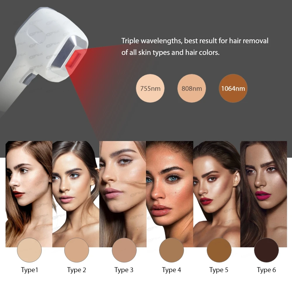 808nm diode laser 4 wavelength 755 808 940 1064nm diode laser hair removal machine