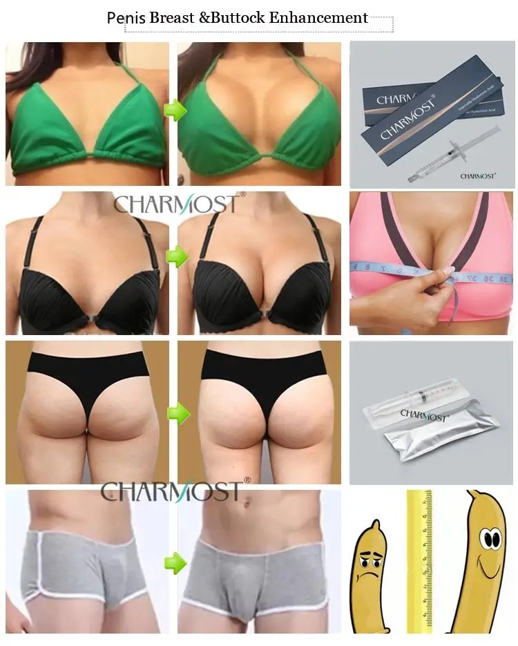 Hot Selling Charmost Dermal Filler Manufacturer Cross-linked Hyaluronic Acid Injection For Breast Buttocks Ass Enlargement
