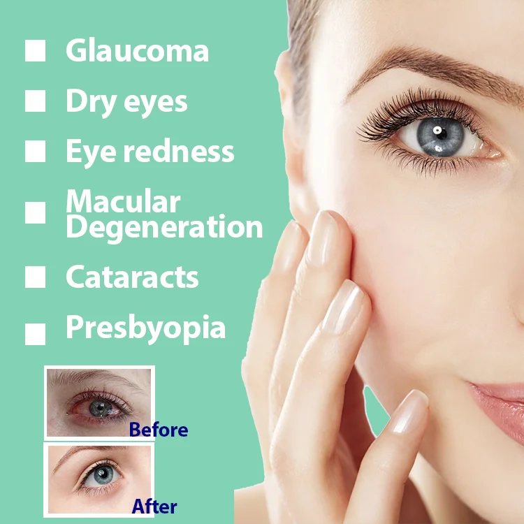 5ml 7.5ml Eye Drops Customized Wholesale from China Supplier Manufacturer Production Export Trade