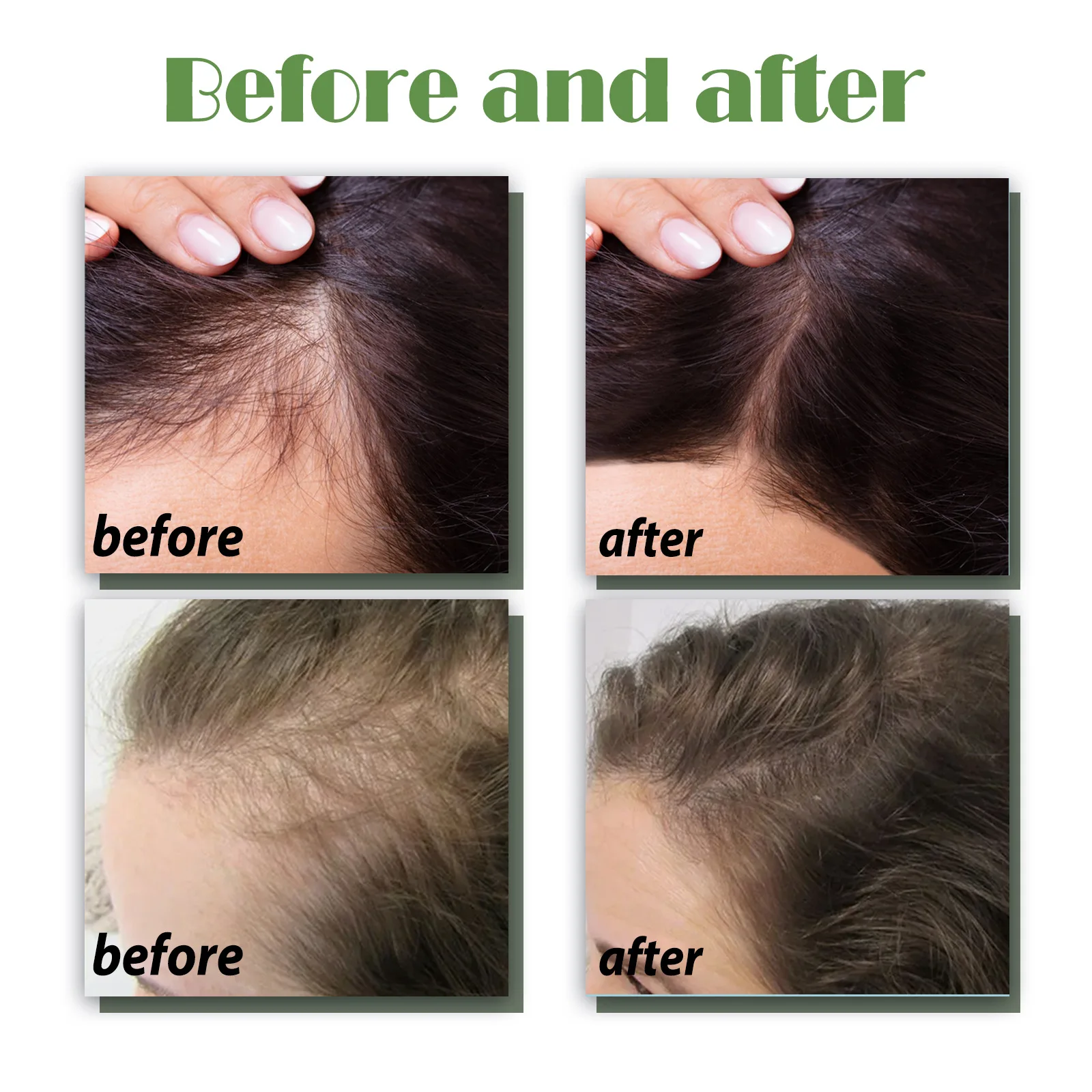 Hot Selling Ginger Nutrient Oil and Serum Strong Hair Root Growth Thickening Scalp Massage for Hair Regrowth