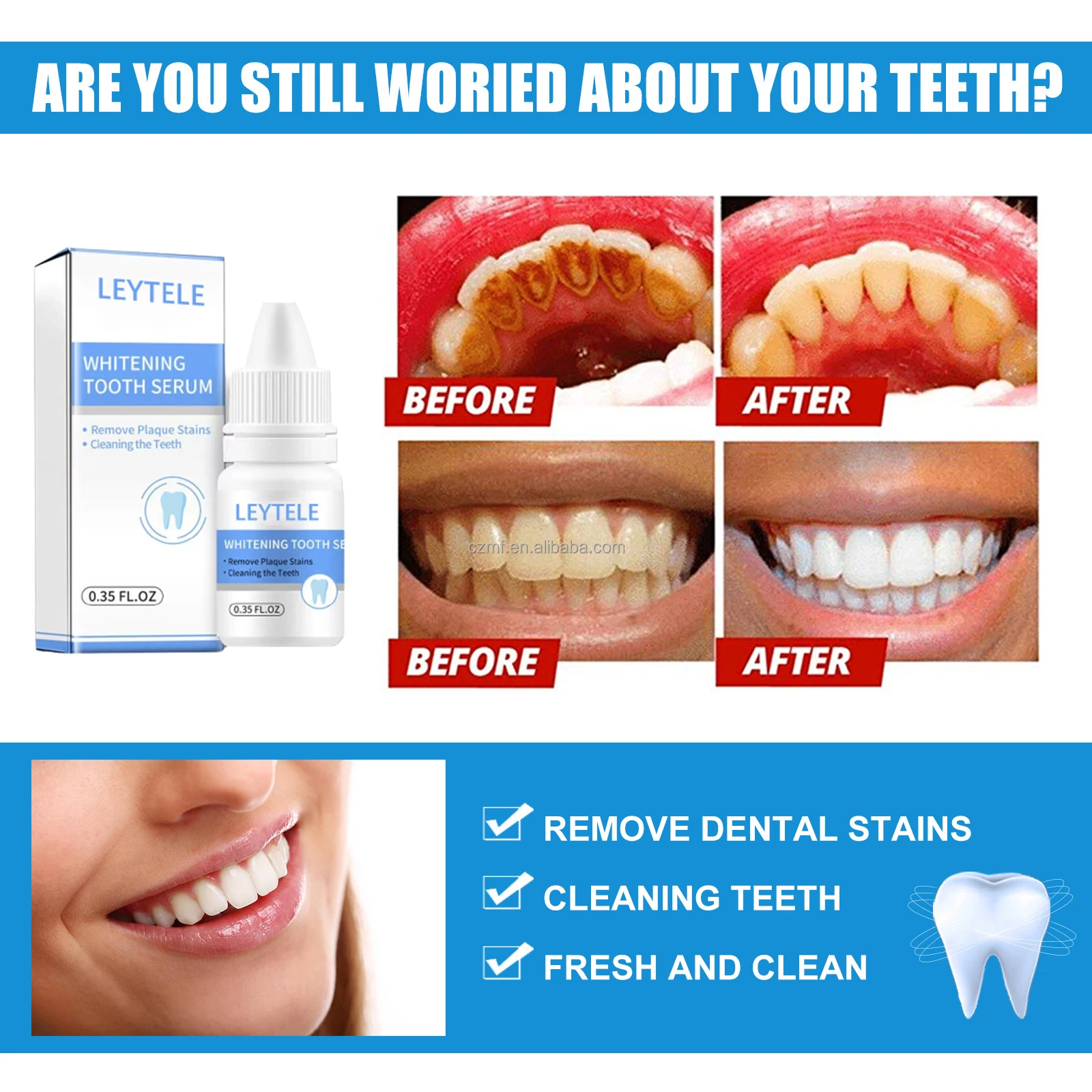 Custom Logo Private Label Professional Easy Fast Removes Plaque Stains Tooth Bleaching for Teeth Whitening Serum