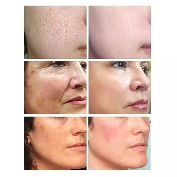 Custom Skin Moisturizer Biological Cellulose Disposable Face Sheet Whitening Bio Cellulose Facial Mask