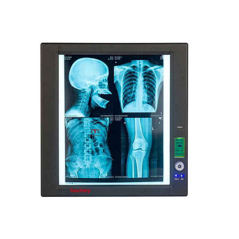 HOCHEY MEDICAL Ultra Bright LED Thin Panel Film Negatoscope Led X-ray