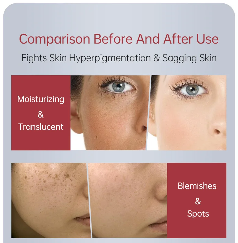 New JellyPrim Whitening Face Serum Anti Aging Acne Remove Dark Spots Shrink Pores Serum Skin Care Korean Cosmetics Beauty Health