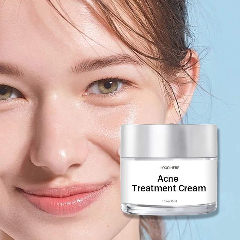 Acne treatment cream Beauty Night Hydrate Corrector Knuckle Remover Dark Spot Body Whitening Cream For Black Skin