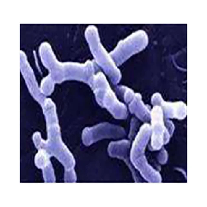 
High quality HACCP ISO22000 HALAL probiotic powder lactobacillus acidophilus probiotics capsule 