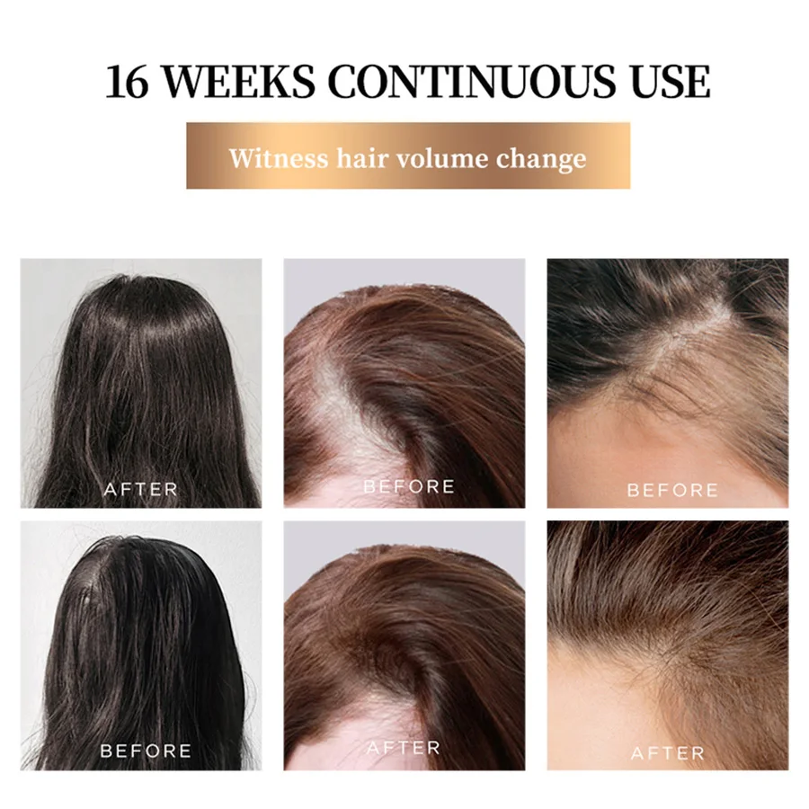 MULTI-PEPTIDE HAIR CARE ESSENCE 30mL Thicker Natural Organic Bald Treatment Anti Hair Loss Hair Growth Serum