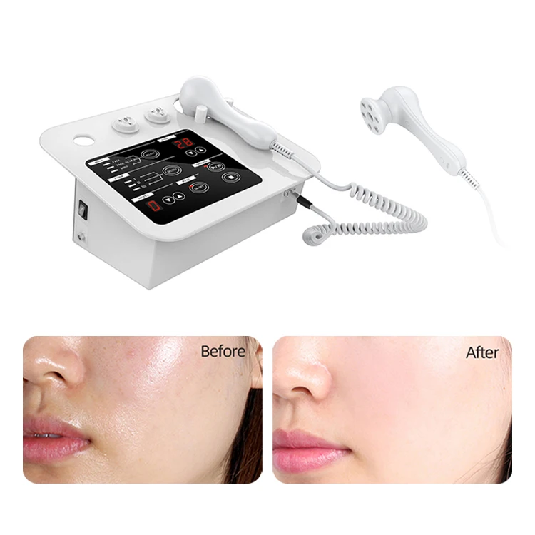 Facial Skin EMS No-needle Mesotherapy Electroporation for face lifting and body slimming