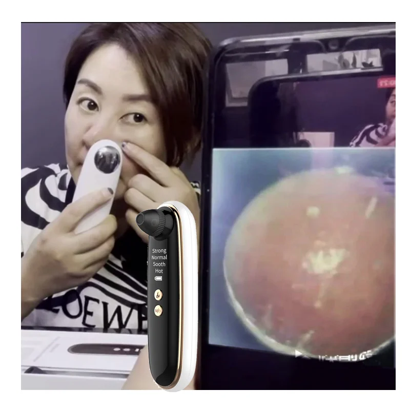 
Truelybeauty Appliance Remover Blackheads Visual Blackhead Meter Pore Cleaner Blackhead Remover 