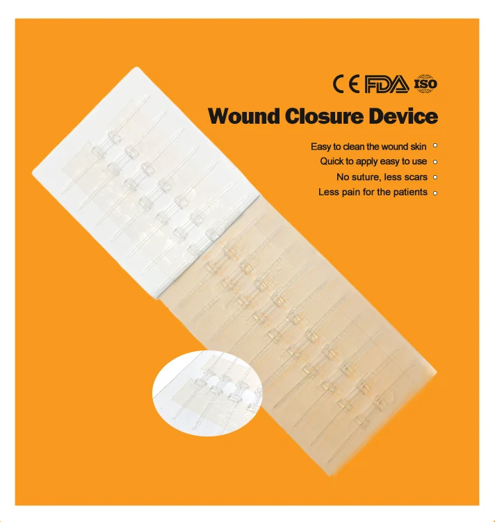 Медицинское устройство для растяжки кожи, надежное устройство для ран