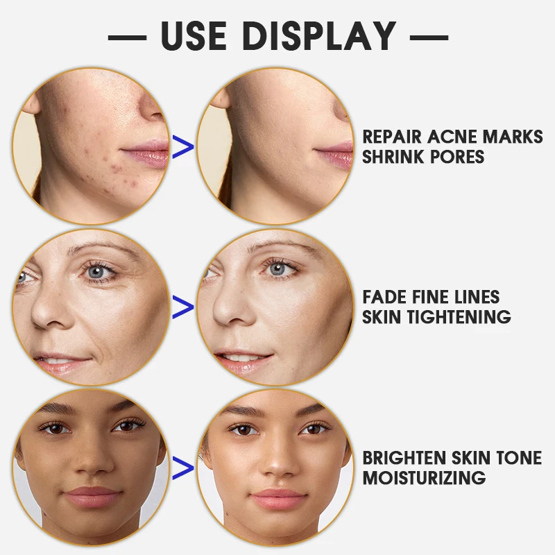 Beauty Oligopeptide Freeze-dried Powder Sulfate-free Anti-aging and Trehalose & Collagen Lyophilized Powder Anti Wrinkle