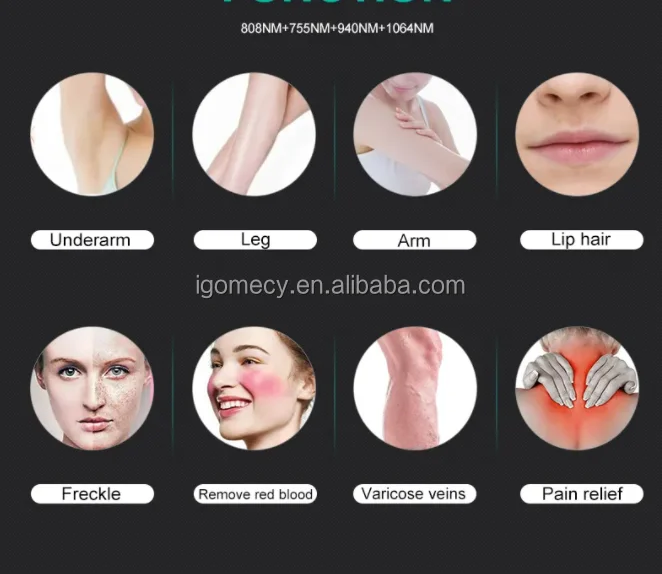 Best-selling-808nm-1064nm-diode-laser-hair-removal-machine-painless-spots-treatment-machine-K16-808