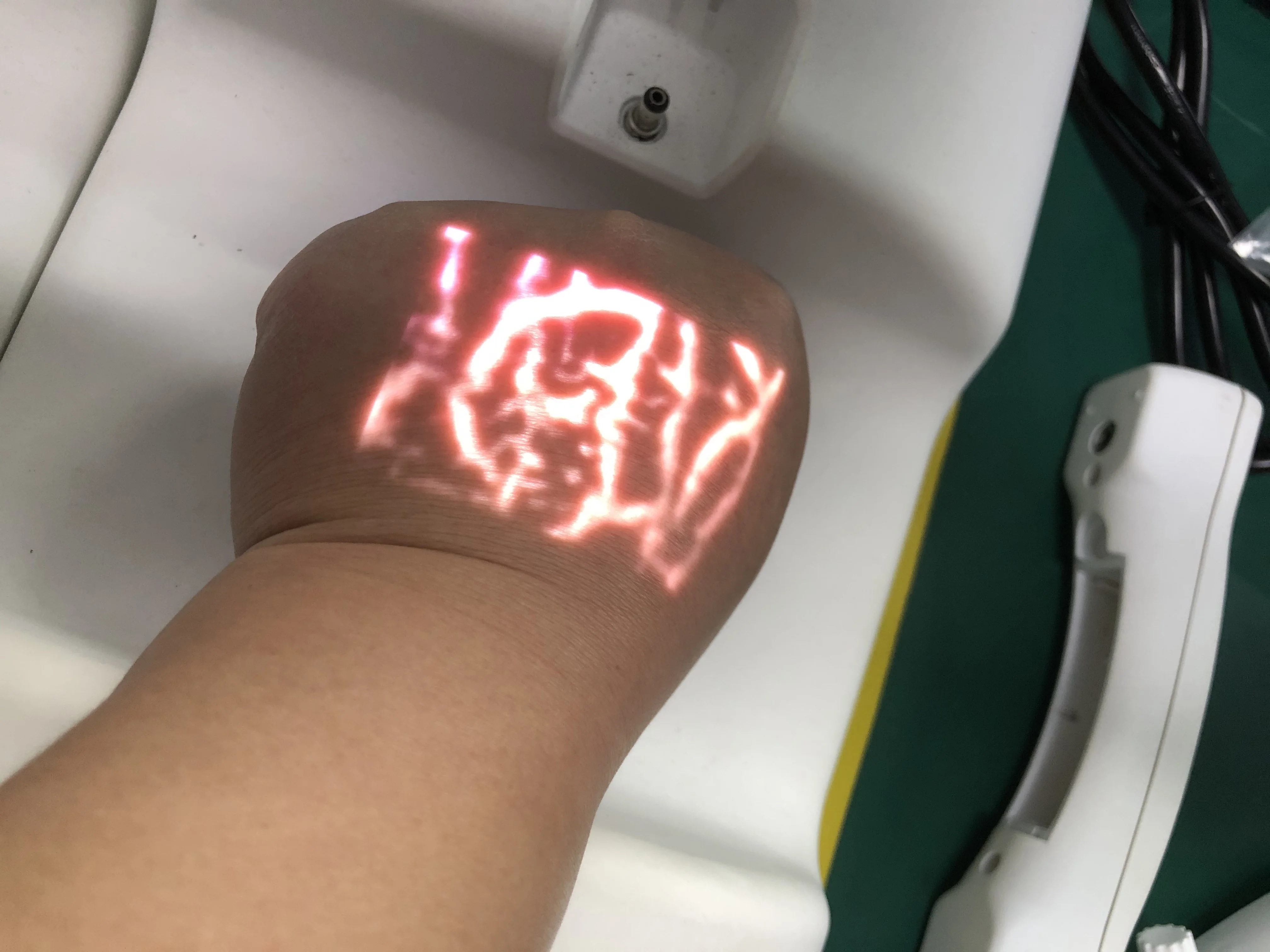 
mobile model medical vein locator infrared adjustable projection vein finders 