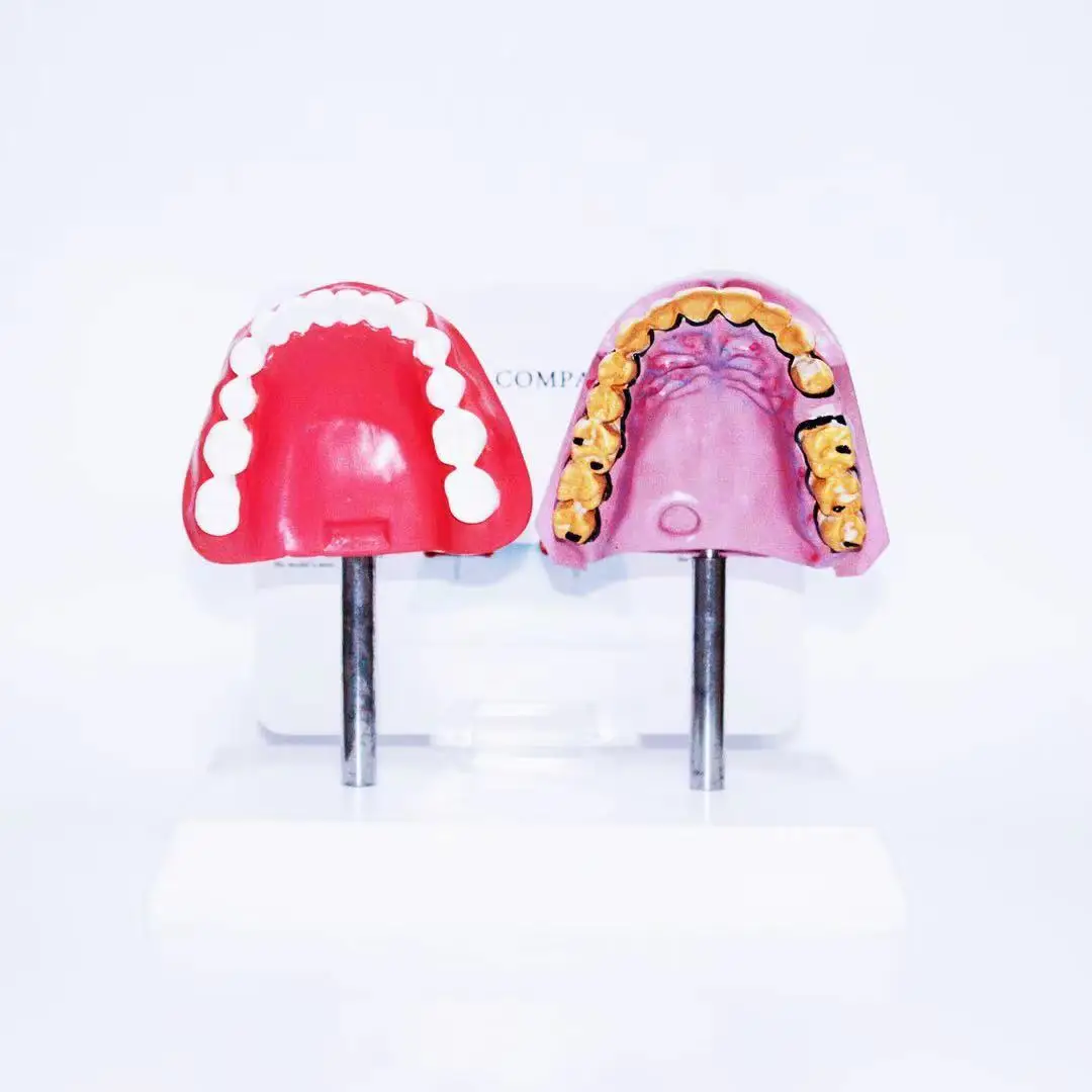 Human oral dental model, yellow teeth, caries and healthy teeth comparison model
