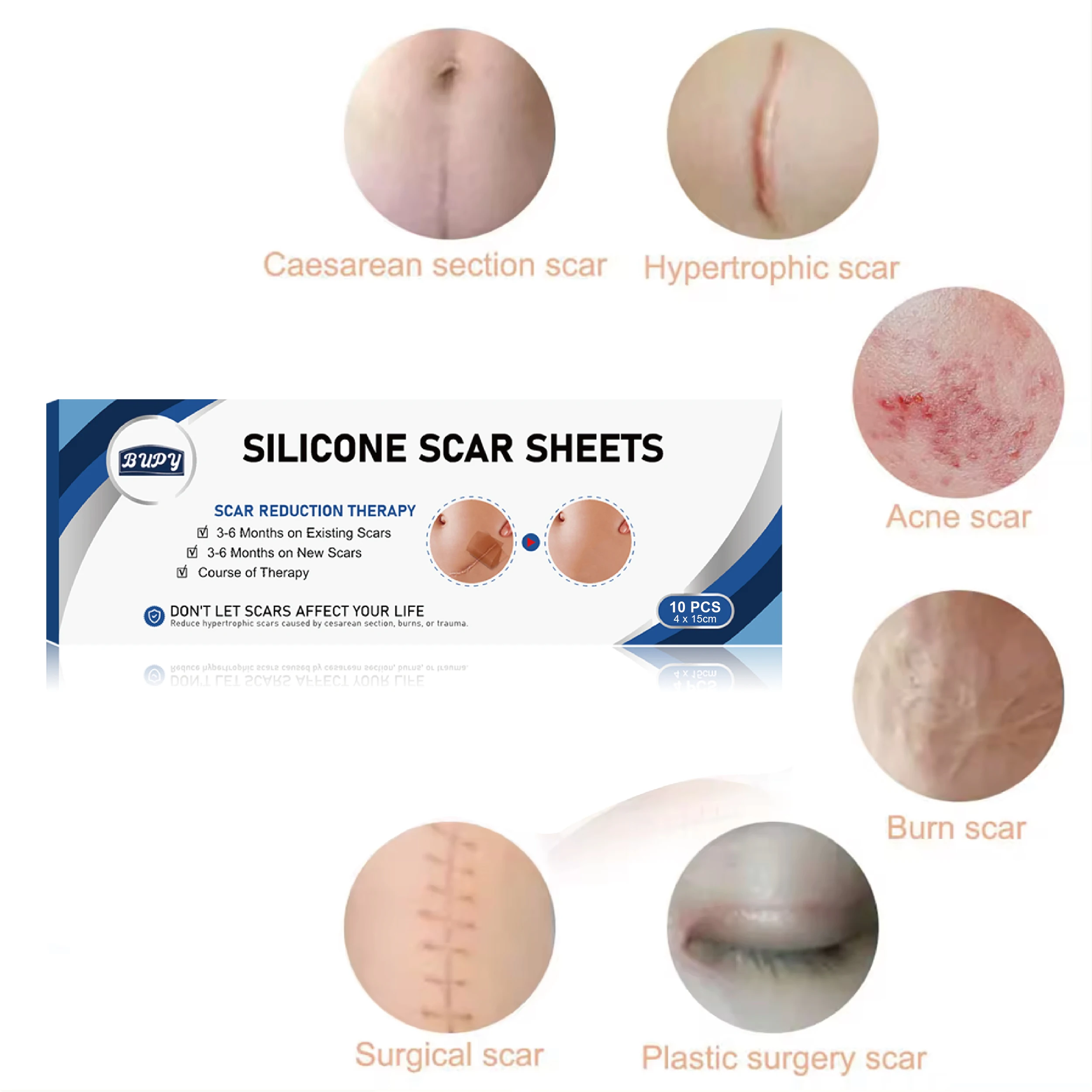 Силиконовые Пластыри для удаления шрамов