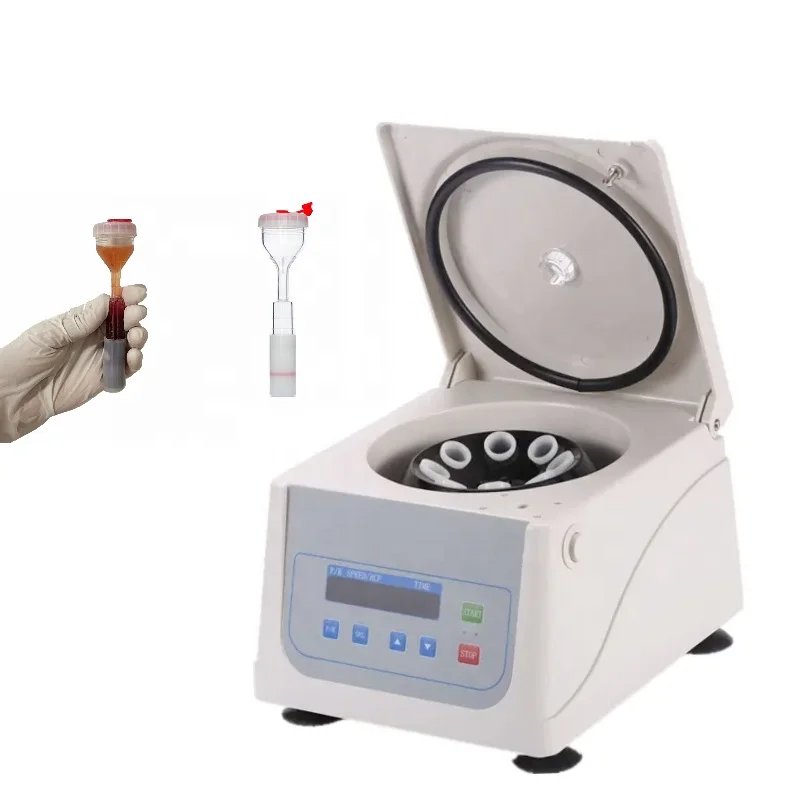 15ml Y-Type PRP Tube: a Powerful Tool for Skin Hair Dental and Orthopedic Aesthetic Improvement