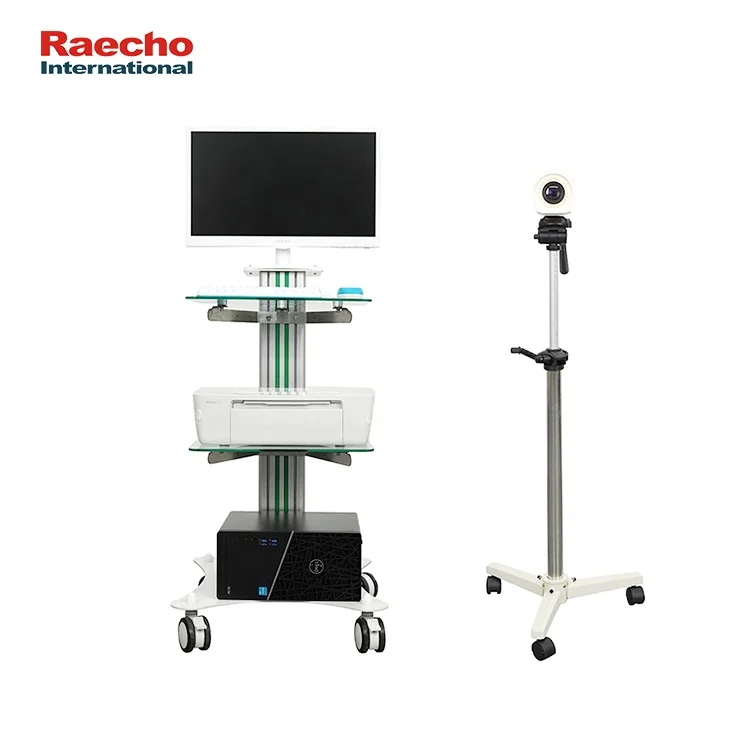 New Arrival Portable Vagina Colposcopy Gynecology Digital Video Colposcope Camera Machine