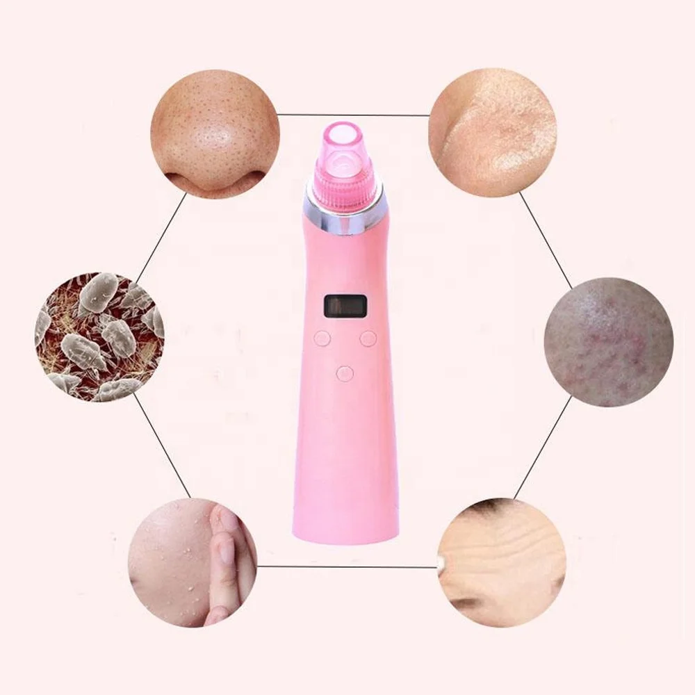 Electric comedo pore suction companies in need for distributors new arrivals new inventions device in china beauty product
