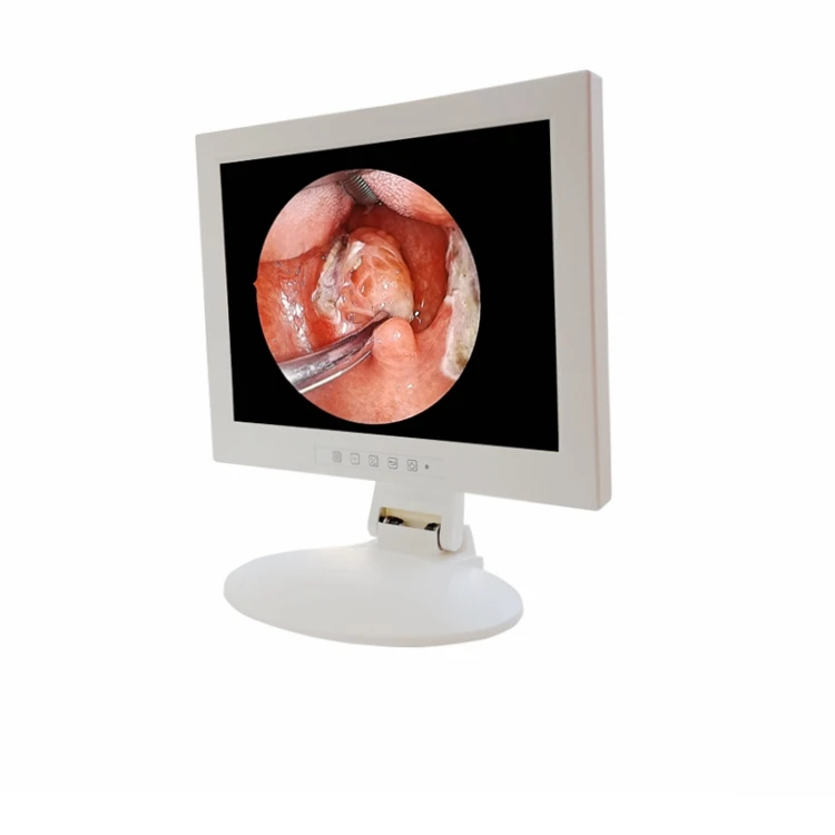 Медицинский прибор для измерения 15 дюймов Эндоскопии Монитор дисплей для хирургии