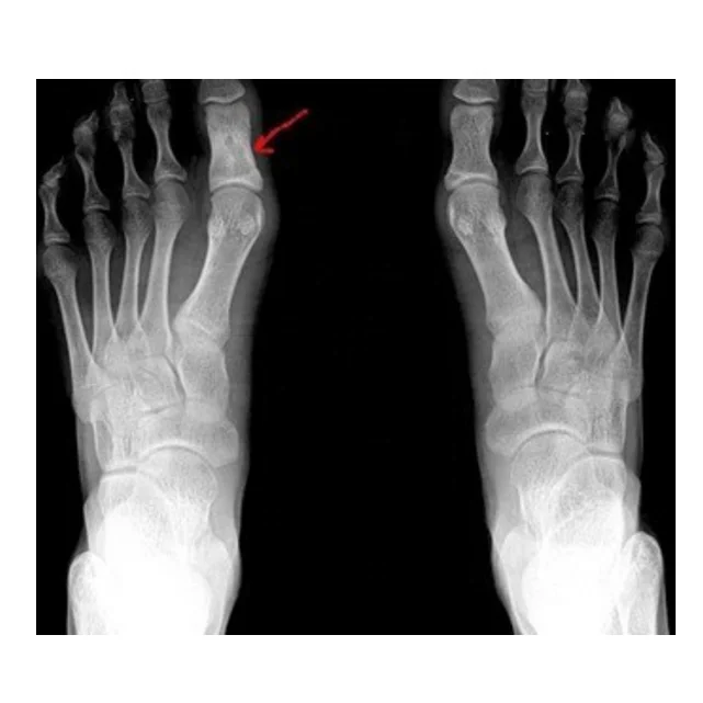 
X ray dry thermal Kenid digital blue base film factory hospital medical fuji dihl dry thermal medical film 