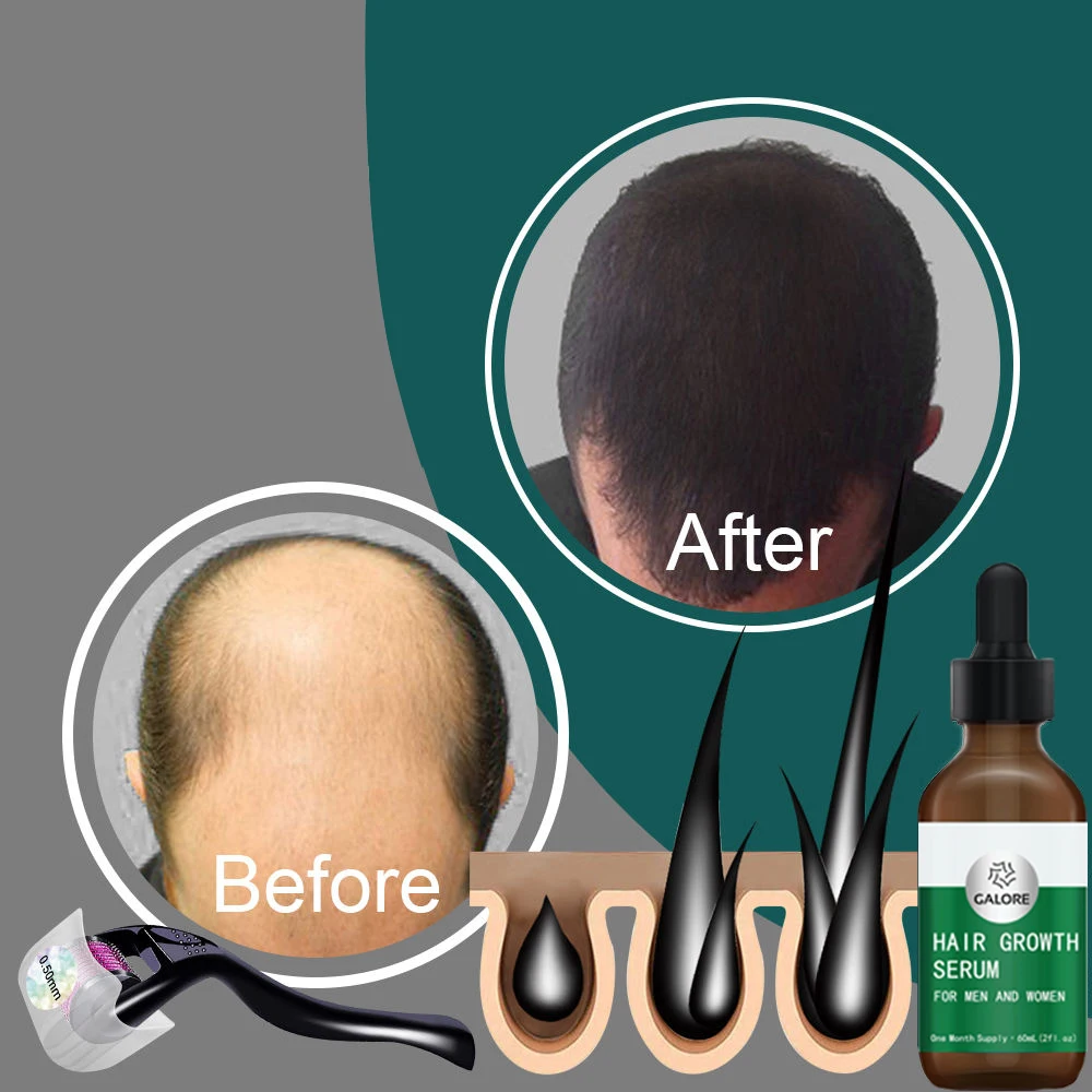 100% Natural   Hair Growth Serum Private Label mix herbs  Oil for Men and Women