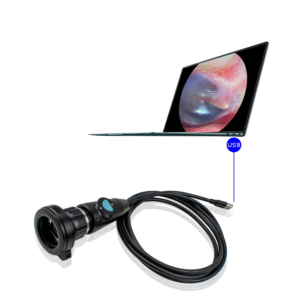 Medical New type HD portable mini ent endoscope usb camera/portable ent endoscope for inspection