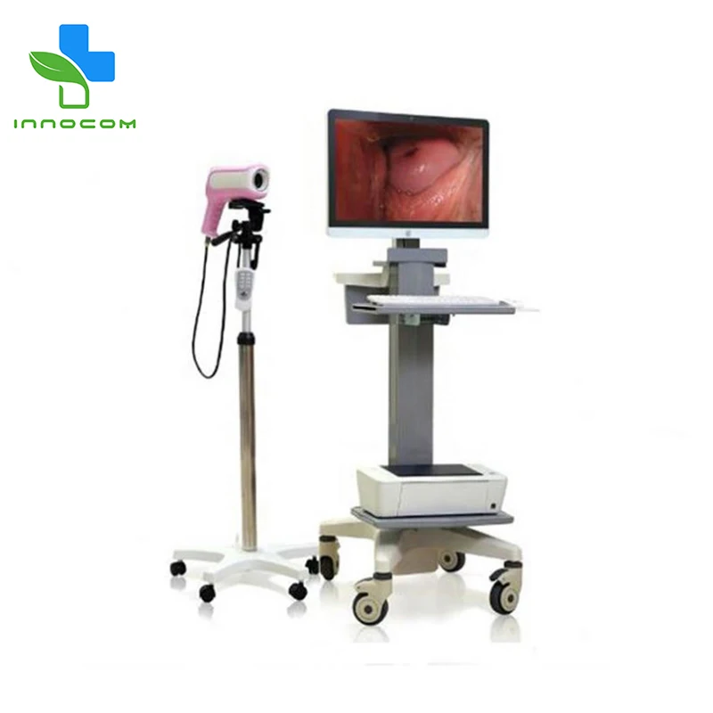 Оптовая продажа китайское медицинское оборудование цифровой видеокольпоскоп для гинекопа инфракрасный кольпоскоп