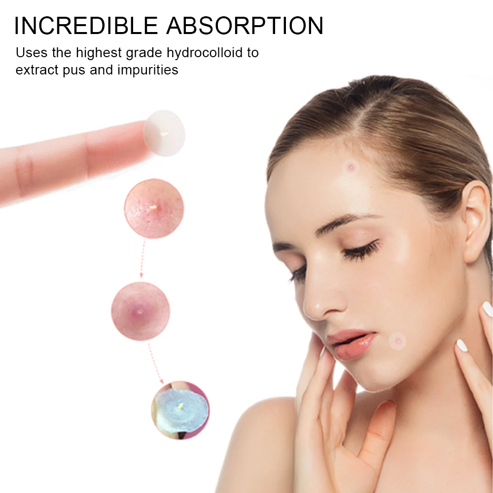 In stock 144 Pcs Acne Pimple Master Patch Waterproof Pimple Patch Hydrocolloid Acne Patch