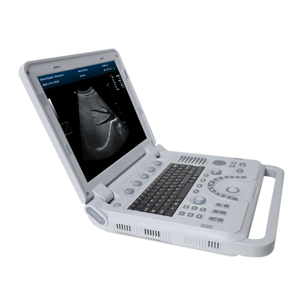 Ультразвуковое оборудование CONTEC CMS1700B doppler портативный 3D 4D