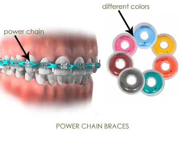 
Orthodontic Elastic Power Chain of RS MEDICO 