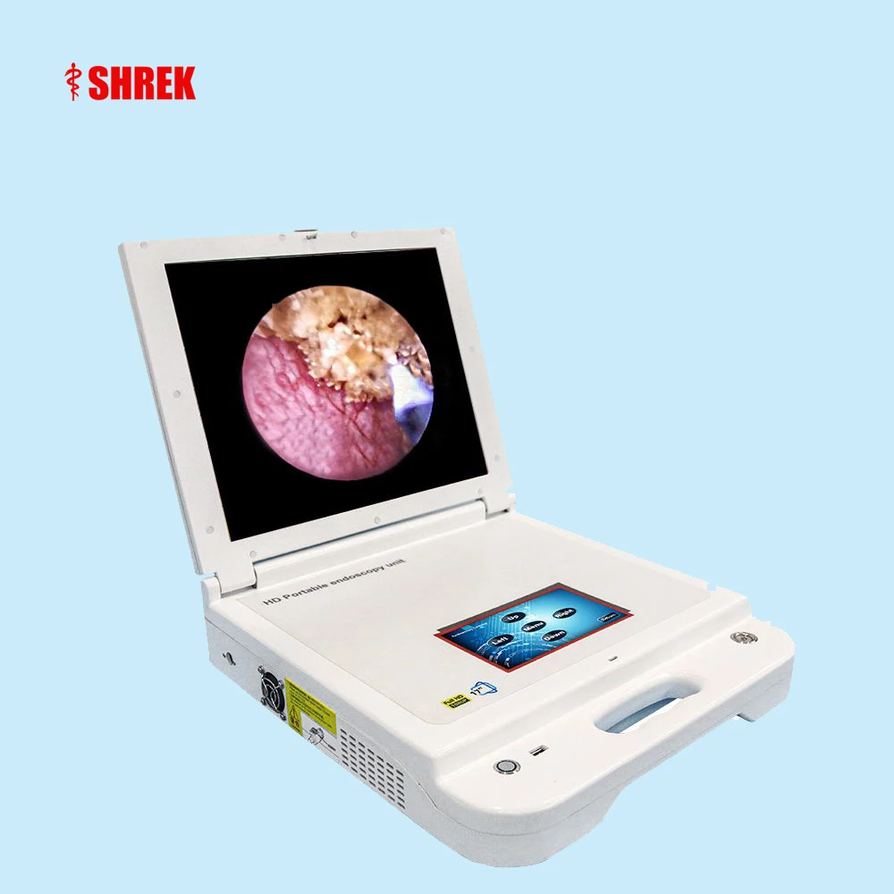 Low price portable medical endoscopy set hd rigid gynecological hysteroscopy camera system