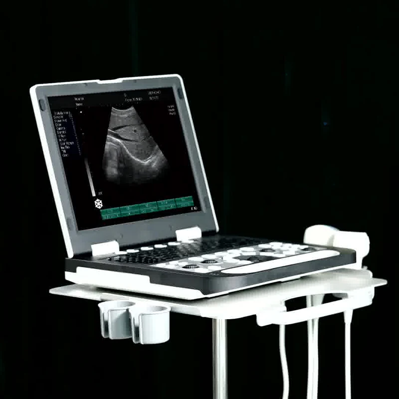 JQ-N50 Portable 15 inches LED display animal pregnancy test ultrasound scanner full digital laptop vet ultrasound