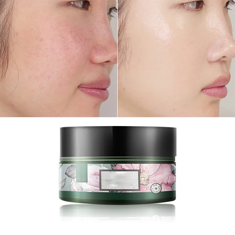 hyaluronic acid glycolic acid effective and quality organic natural face cream whitening face cream for pigmentation