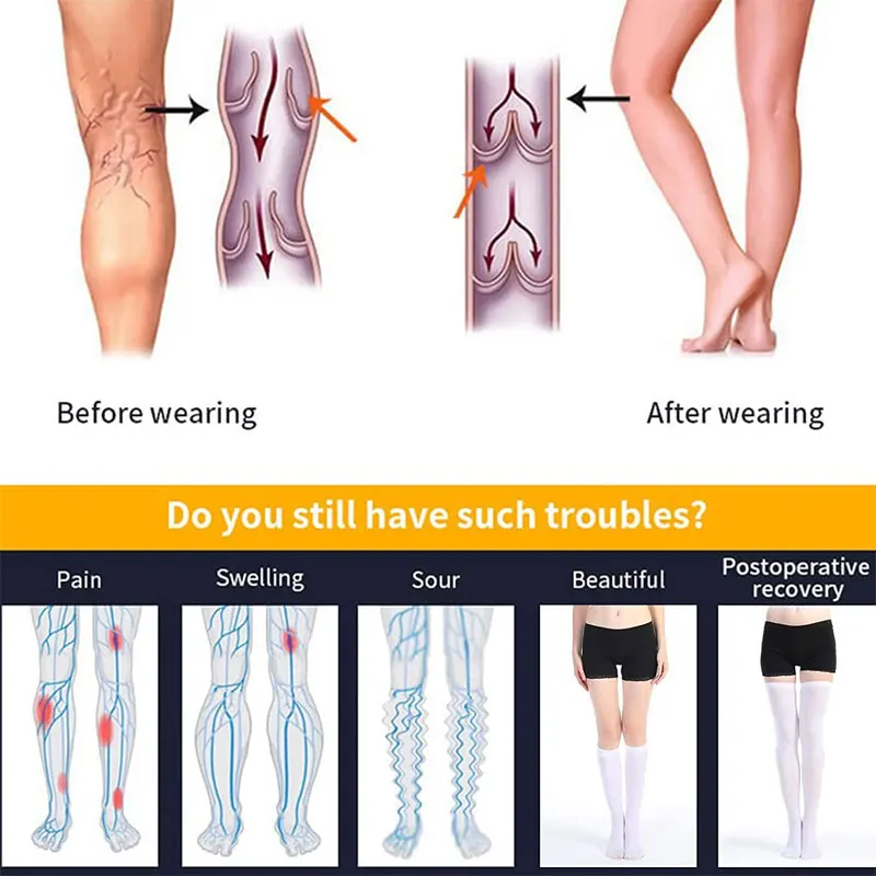 15-21mmhg medical compression stockings anti-embolism socks to prevent varicose veins socks thigh high for teachers and nurses