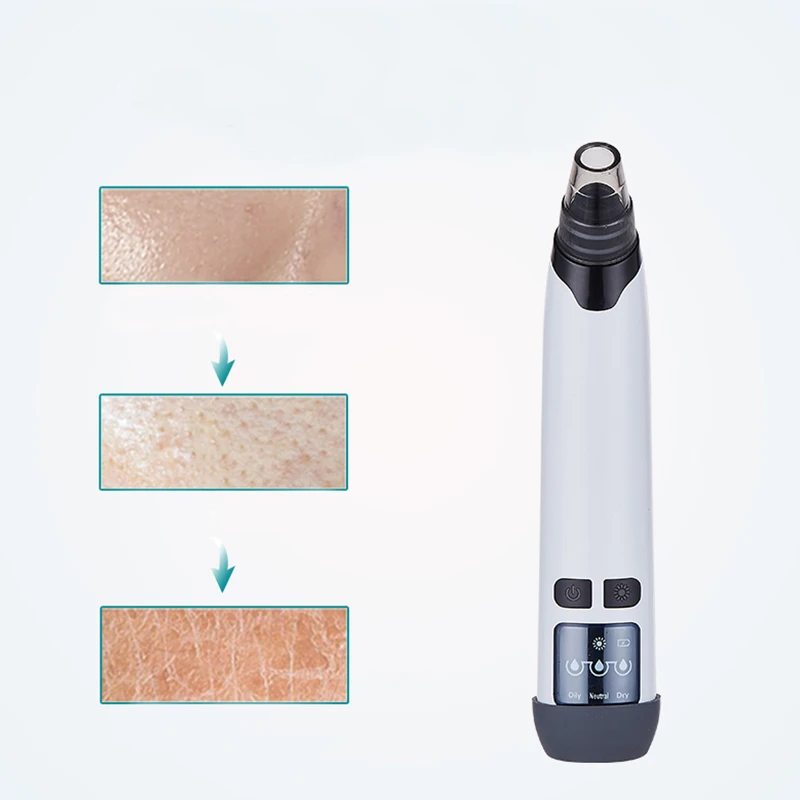 
White Green 3 Step Visual Face Comedone Pore Vacuum Blackhead Remover 