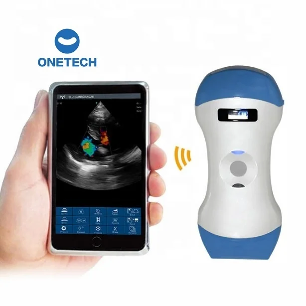 Palm ultrasound scanner doppler micro convex wifi wireless probe ultrasound probes 3 in 1 for android laptop