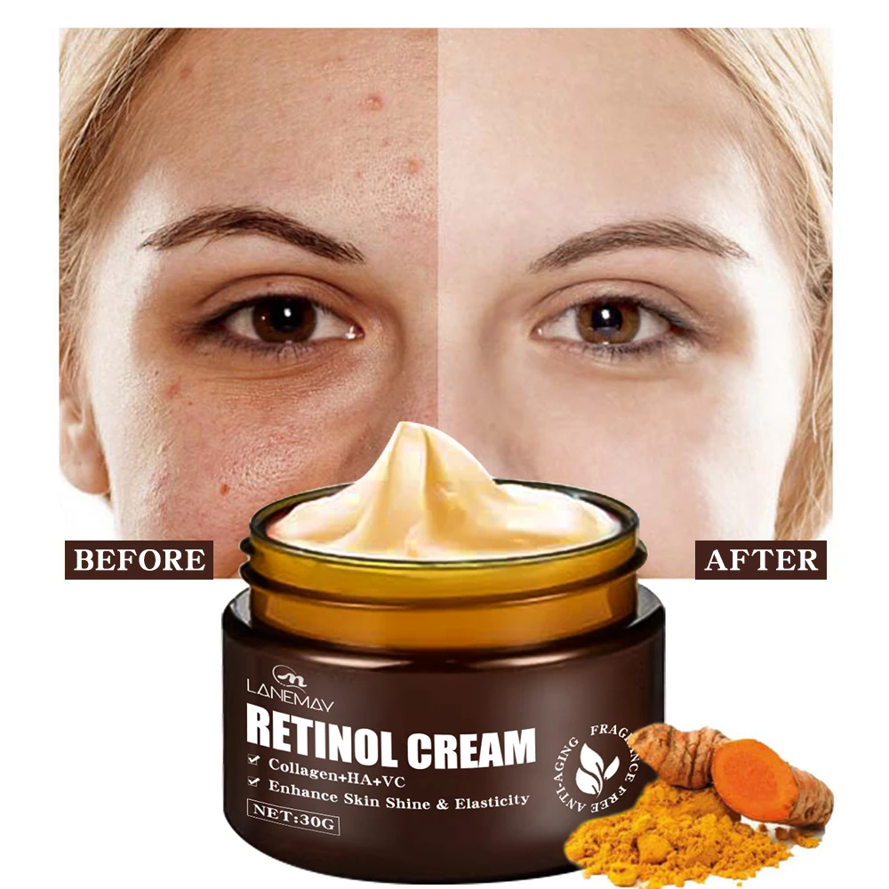 private label organic Remove Wrinkle Vitamin E Hyaluronic Acid Moisturizer anti aging 3% retinol face cream