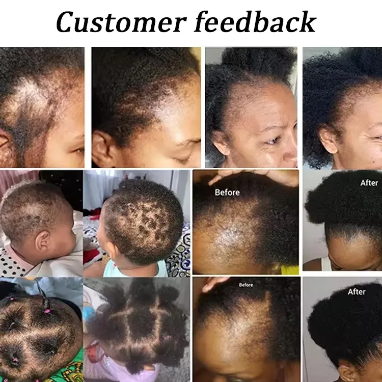 African All Natural Hair Treatment Products Miracle Rosemary Mint Hair Growth Oil Serum for African Hair Natural Babies