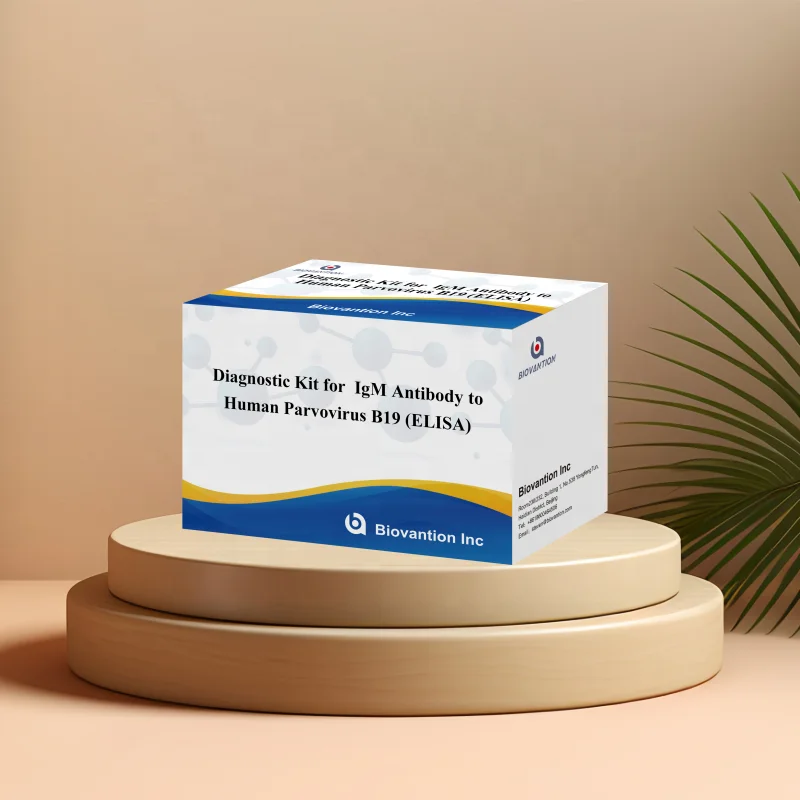 Elisa Diagnostic Kit for Human Parvovirus B19 IgM Antibody for hospital and lab
