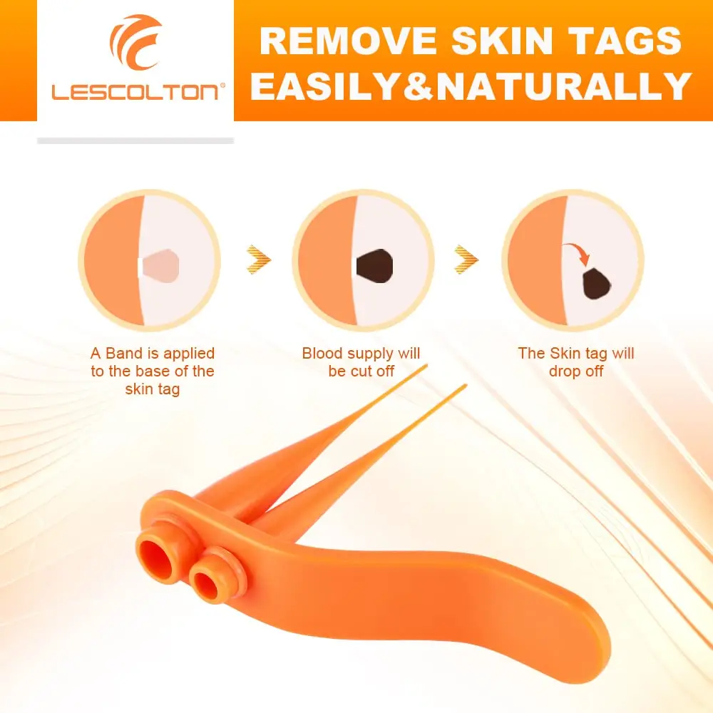 Orange Set Skin Tags Removal Kit Home Use Mole Wart Remover Equipment Micro Skin Tag Treatment Tool Easy To Clean Skin Care Tool