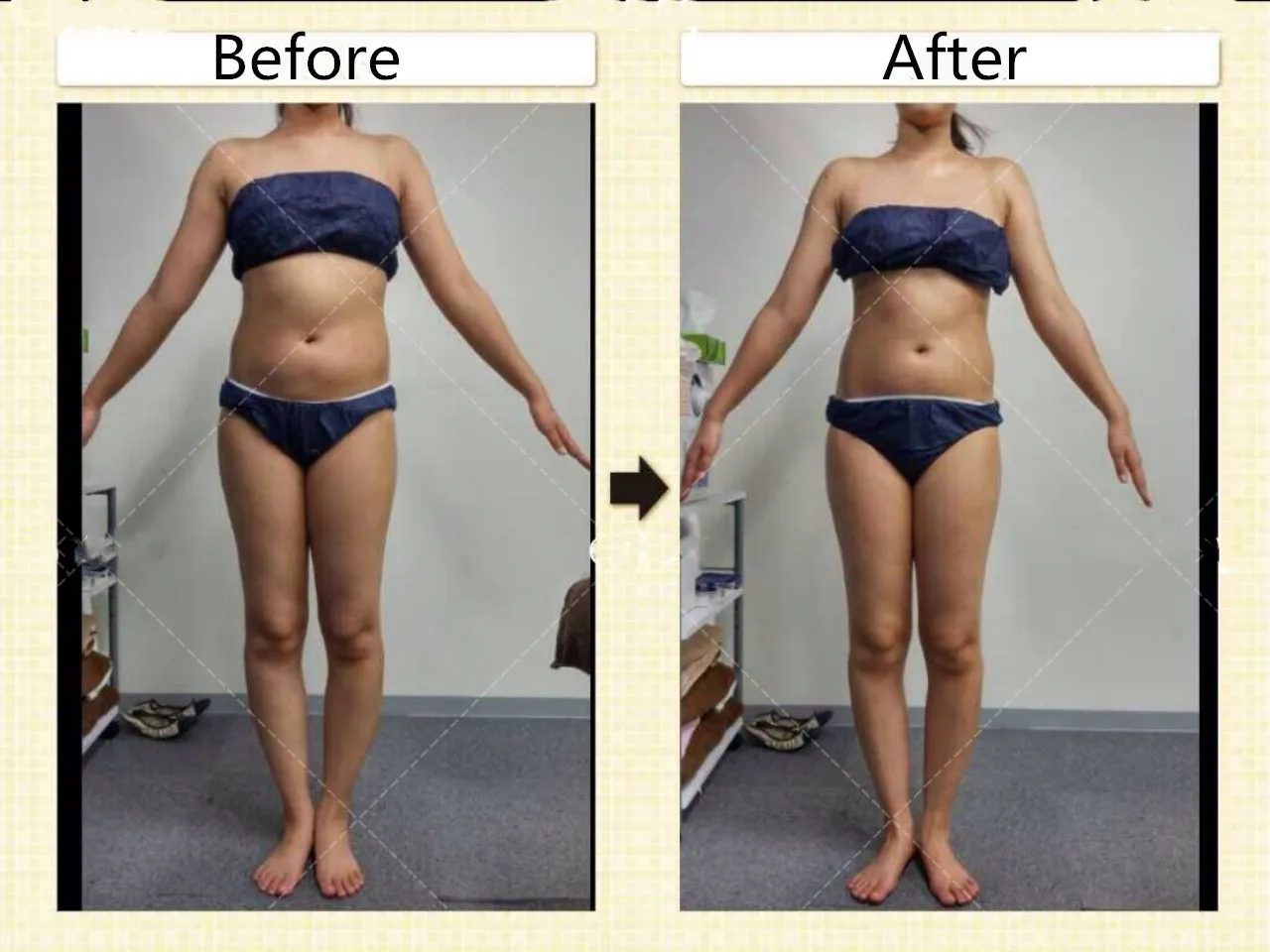 
Anti Cellulite Hot Cream Fat Burner Gel Slimming Cream Massage Hot Anti-Cellulite Body Massager Weight Loss Cream 